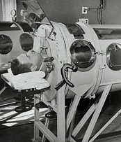 Right photo. Man in an iron lung looking into the mirror mounted above