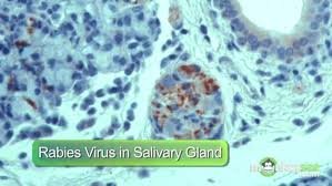 Rabies virus in salivary gland