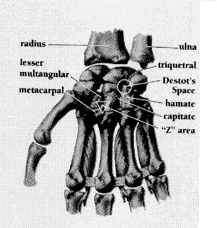 Zugibe's hand picture