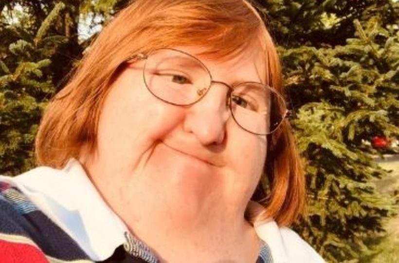 Woman Called 'Too Ugly' By Trolls Posts One Selfie Everyday