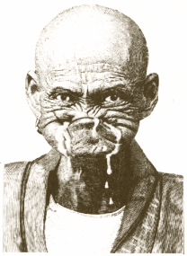 http://kylehuwer.files.wordpress.com/2008/03/rabies.png