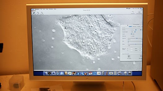 A colony of human embryonic stem cells is seen on a computer monitor at the University Wisconsin-Madison.