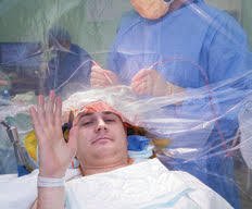 Awake craniotomy for brain tumors - Dr Prem Pillay